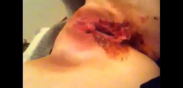 Poarn Com - bleeding poarn XXX Videos - watch and enjoy free bleeding poarn ...